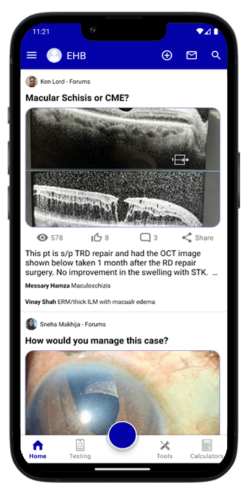 Eye Handbook Ophthalmology Mobile app
